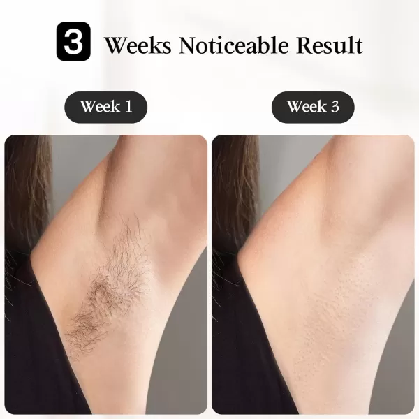 JOVS Laser Hair Removal 24J Energy IPL Hair Removal for Women and Men 37F Painless Sapphire IceCooling Tech 6 Modes for Whole Body Hair Removal Device 2 in 1 Skin Rejuvenation 330 Rotation