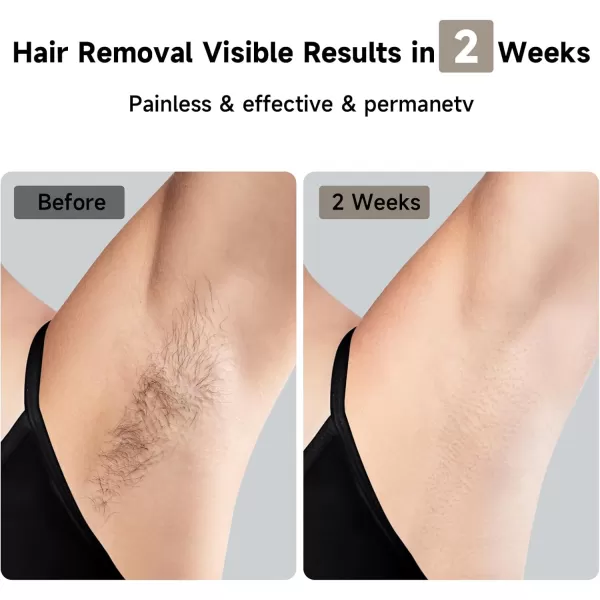 JOVS Laser Hair Removal 37F Painless Hair Removal Device with Sapphire IceCooling 3 in 1 Hair Removal ampamp Skin Rejuvenation for Women and Men 8 Modes Skin Care for Whole Body Touch Screen
