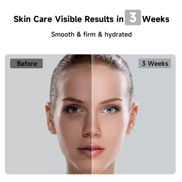 JOVS Laser Hair Removal 37F Painless Hair Removal Device with Sapphire IceCooling 3 in 1 Hair Removal ampamp Skin Rejuvenation for Women and Men 8 Modes Skin Care for Whole Body Touch Screen White