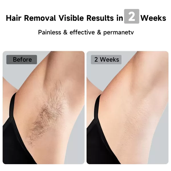 JOVS Laser Hair Removal 37F Painless Hair Removal Device with Sapphire IceCooling 3 in 1 Hair Removal ampamp Skin Rejuvenation for Women and Men 8 Modes Skin Care for Whole Body Touch Screen White