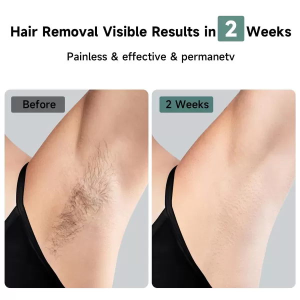 JOVS X IPL Hair Removal for Women and Men 3in1 Hair Removal Device with Cooling SystemTouch ScreenUnlimited Flashes Painless Hair Remover Permanent at Home for Face Leg Arm Armpit Bikini Line
