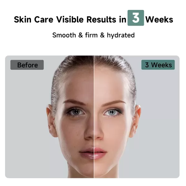 JOVS X IPL Hair Removal for Women and Men 3in1 Hair Removal Device with Cooling SystemTouch ScreenUnlimited Flashes Painless Hair Remover Permanent at Home for Face Leg Arm Armpit Bikini Line