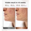 imageJOVS Red Light Therapy Mask for Face LED Face Mask with NearInfrared Light Rechargeable 4 Modes Portable AntiAging Skin Care Device for Home UseBrown