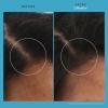 imageLiving proof Scalp Care Revitalizing Hair Treatment for Thicker Fuller Hair 25 Fl Oz